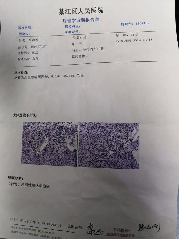 我爷爷,71岁,上周查出来食道癌中晚期